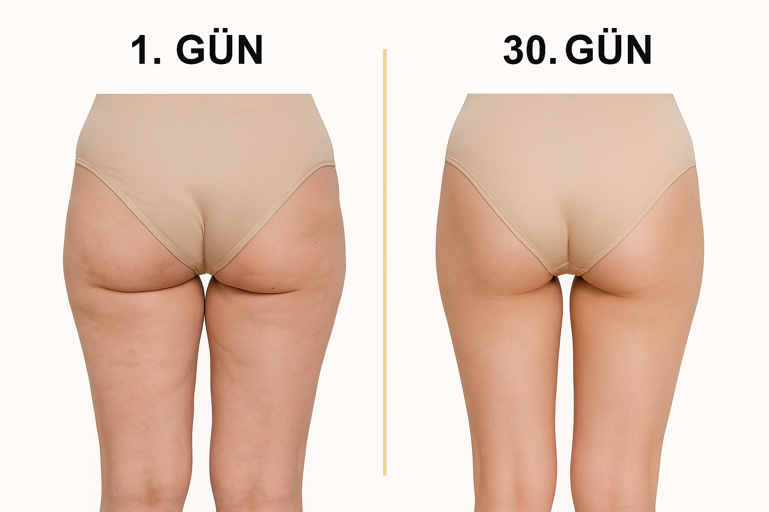 Bacak İnceltme Selülit Giderme, Ödem Atma, Sıkılaştırma Masaj Aleti